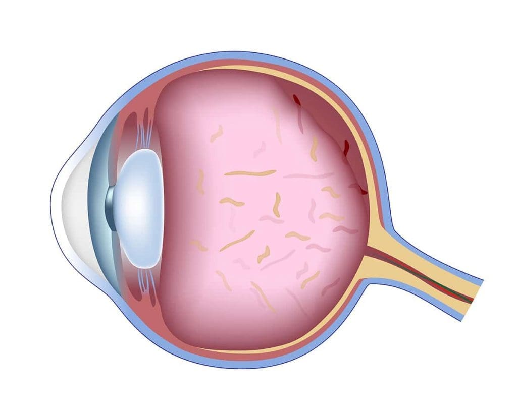 Medical diagram of an eye