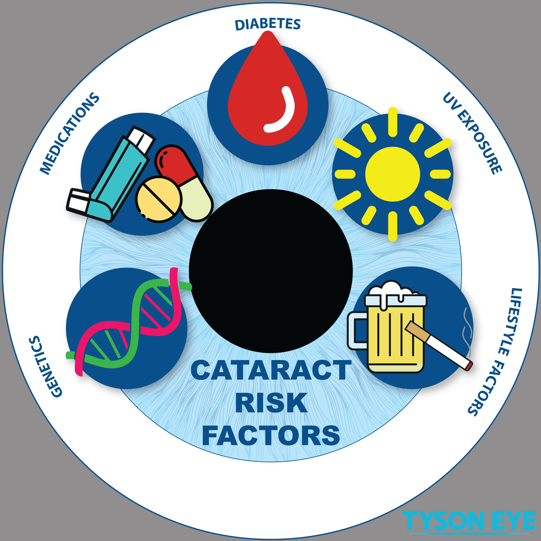 Cataract Risks Infographic