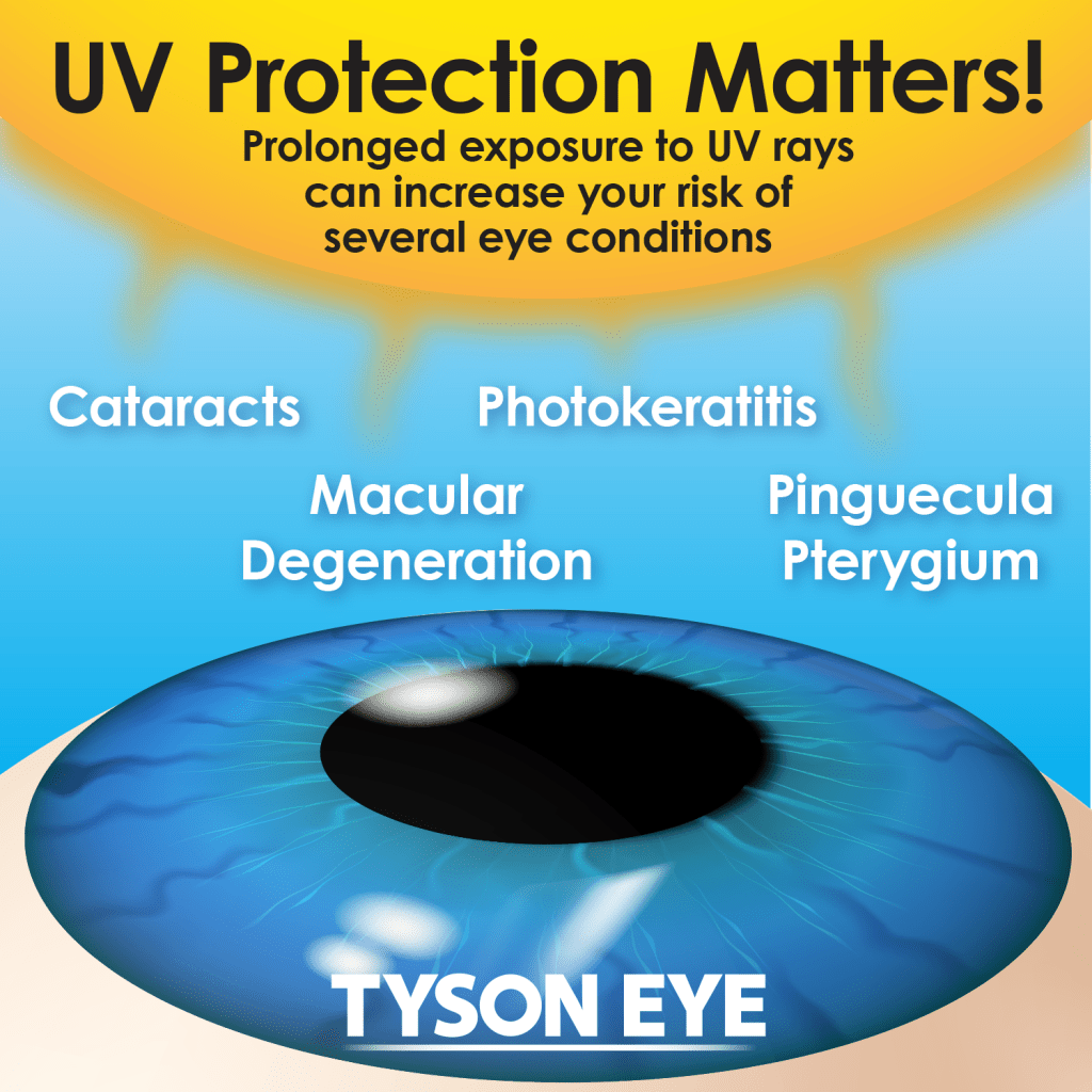 UV Protection Matters Infographic - Protect your vision while in the sun